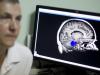 Мозговой штурм: как защититься от инсульта