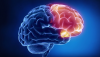 «Возраст мозга» определит риск ранней смерти