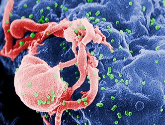 Полезные бактерии стали союзниками против ВИЧ