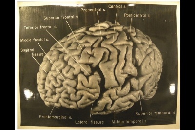 Мозг в разрезе