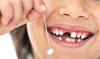 Ученые связали раннее выпадение зубов и скорую смерть