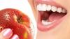 Ученые назвали продукт, защищающий зубы от карьеса