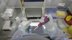 Российские эпидемиологи установили связь между Эболой и гепатитом Б