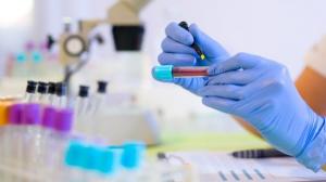 Ученые в США тестируют универсальный анализ крови на рак - Похоронный портал