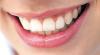 Ученые установили связь между болезнями зубов и ранней смертью