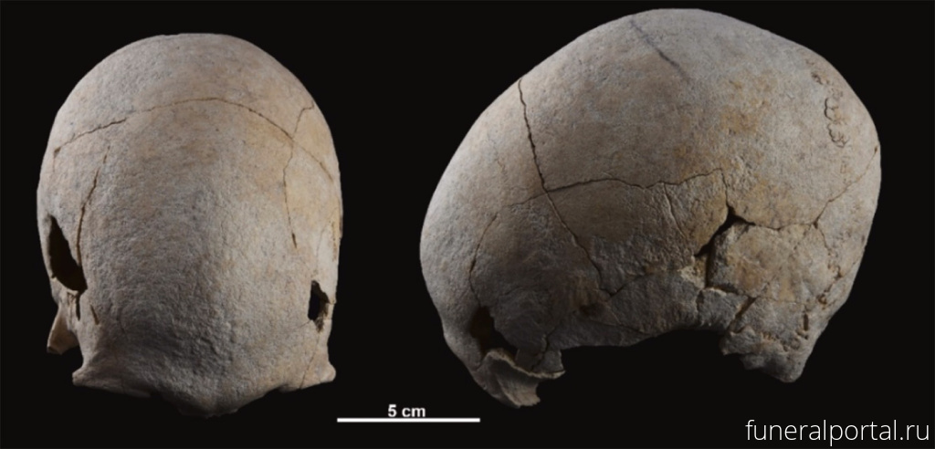 В Испании нашли скелет женщины медного века, пережившей две трепанации черепа - Похоронный портал