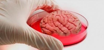 Ученые вырастили в чашке мозг, превратив его в полноценный орган