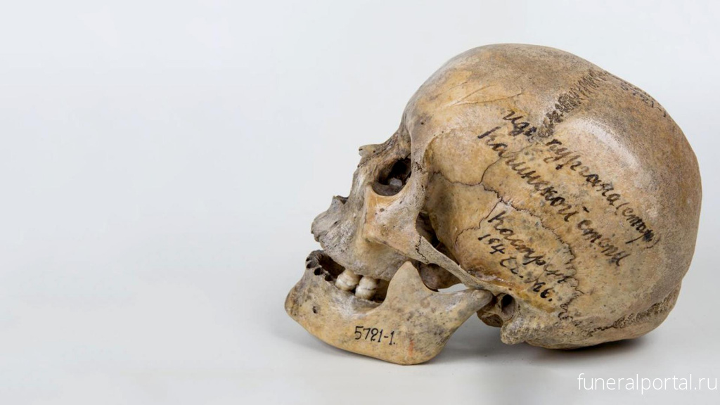 Кости дорогие: черепа из Кунсткамеры расскажут о древних болезнях