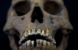 Интернет-аукцион eBay прекратил продажу человеческих черепов и скелетов - Похоронный портал