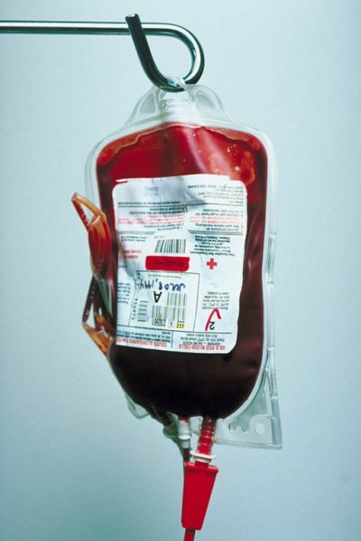Переливание крови омолаживает...