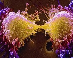 Ученые нашли универсальное средство для лечения всех типов рака