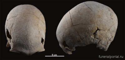 В Испании нашли скелет женщины медного века, пережившей две трепанации черепа - Похоронный портал