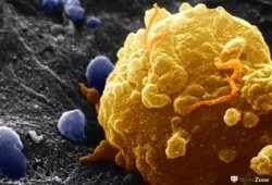 Найден ген, ухудшающий выживаемость при раке
