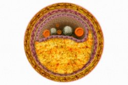 Сахар против атеросклероза