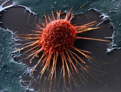 Новые свойства клеток, способные противостоять раку