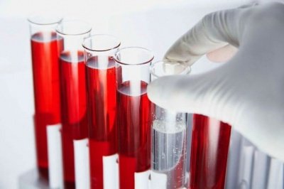 Анализ крови поможет диагностировать рак мочевого пузыря