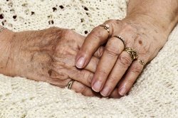 Как пожилым людям избавиться от пигментных пятен на руках